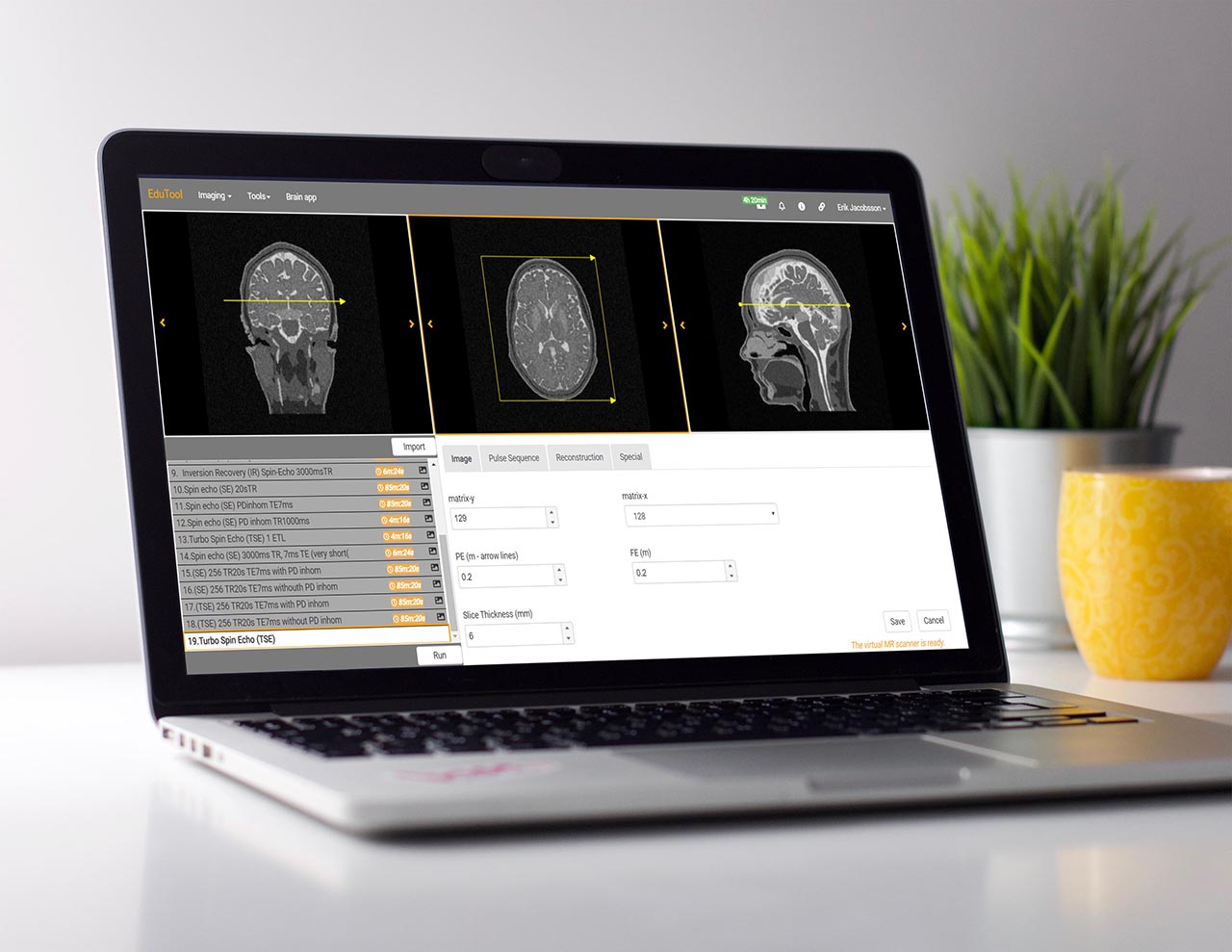 Corsmed MRI simulation platform
